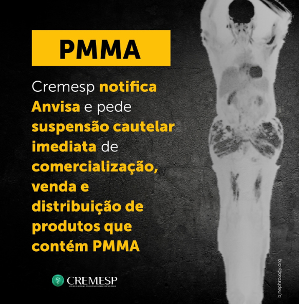 CREMESP notifica ANVISA e pede suspensão cautelar imediata de comercialização, venda e distribuição de produtos que contêm PMMA
